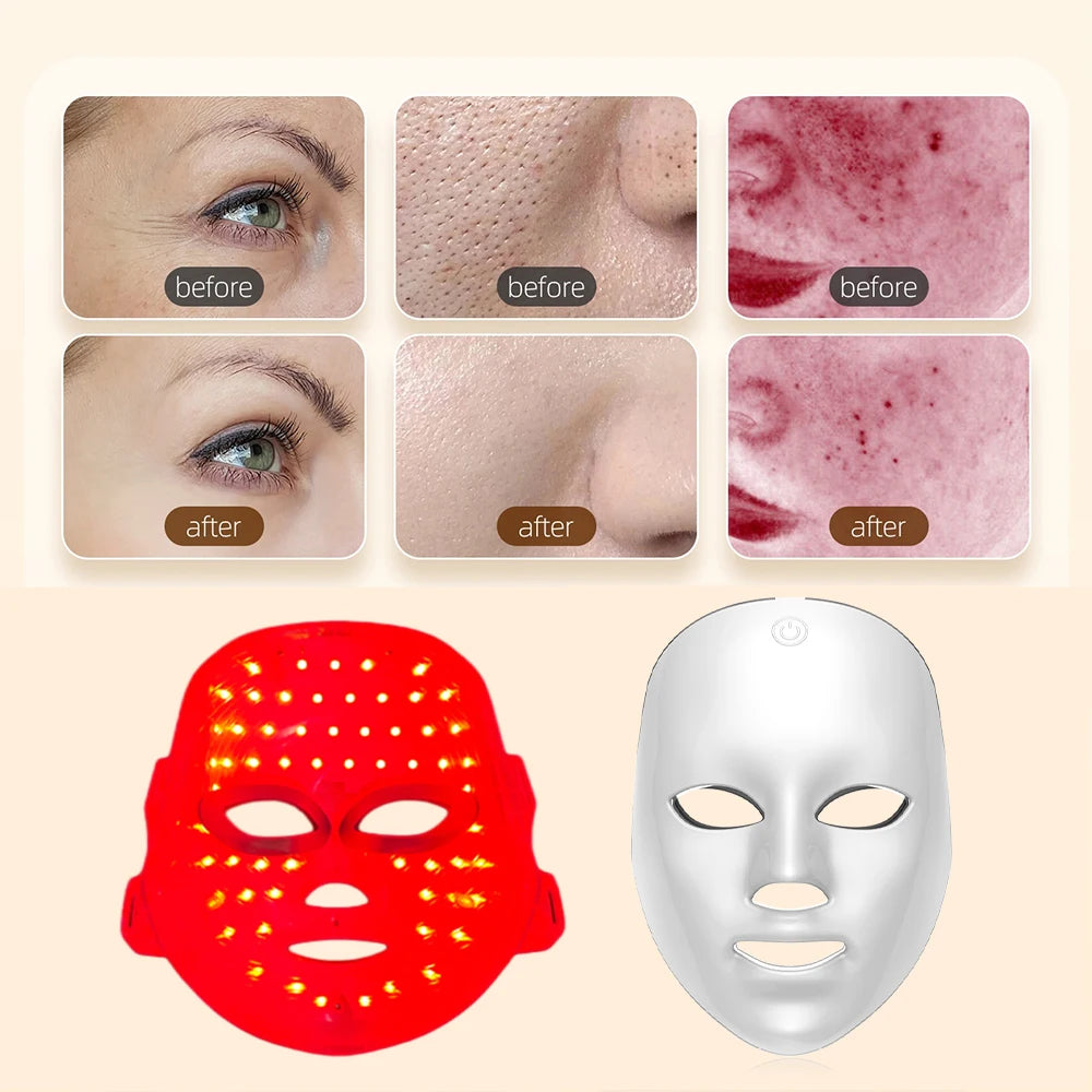 Masque LED Facial 7 Couleurs – Anti-Rides & Rajeunissement